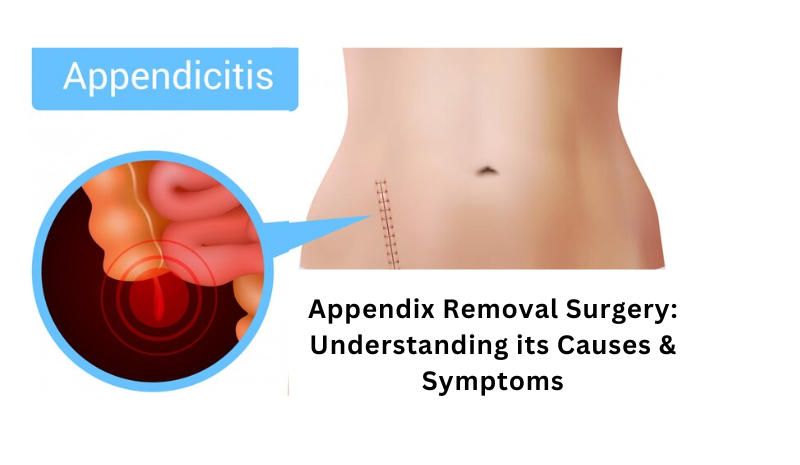 Appendix Removal Surgery: Understanding Its Causes & Symptoms